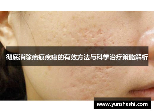 彻底消除疤痕疙瘩的有效方法与科学治疗策略解析